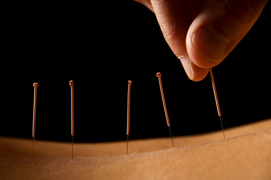 How Acupuncture Helps Cancer Patients Heal