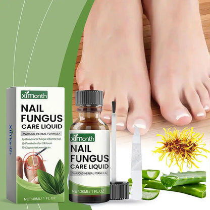 **Ultimate Nail Fungal Treatment - 50g Powerful Serum for Onychomycosis & Paronychia | Restore Healthy Nails & Banish Infections!**