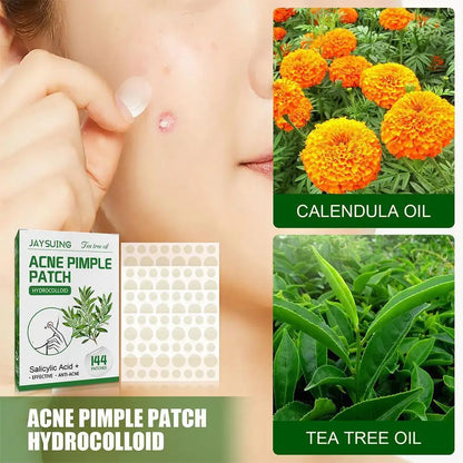 "144 Patches Hydrocolloid Acne Pimple Patches with Salicylic Acid & Tea Tree Oil – Fast Relief for Inflamed Acne & Whiteheads, Translucent Matte Finish for Discreet Healing!"