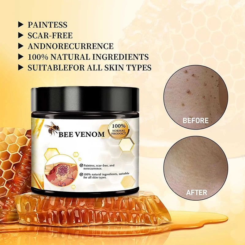 **Experience the Power of Nature: 60ml Bee Venom Skin Care Cream – Intensive Repair for Dry, Itchy Skin on Hands and Feet!**