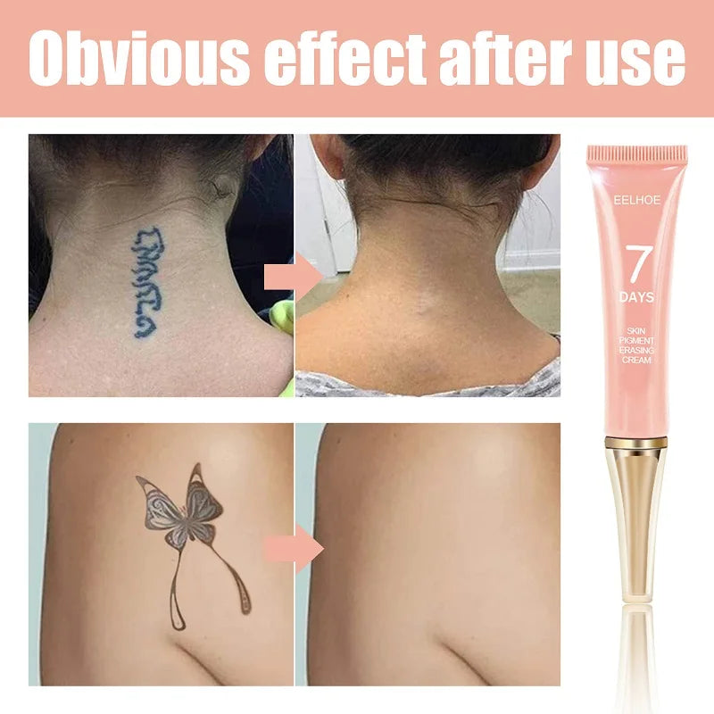 **Effortless Tattoo Removal in Just 7 Days – Pain-Free, Moisturizing Gel for Maximum Strength Results & Radiant Skin Renewal!**