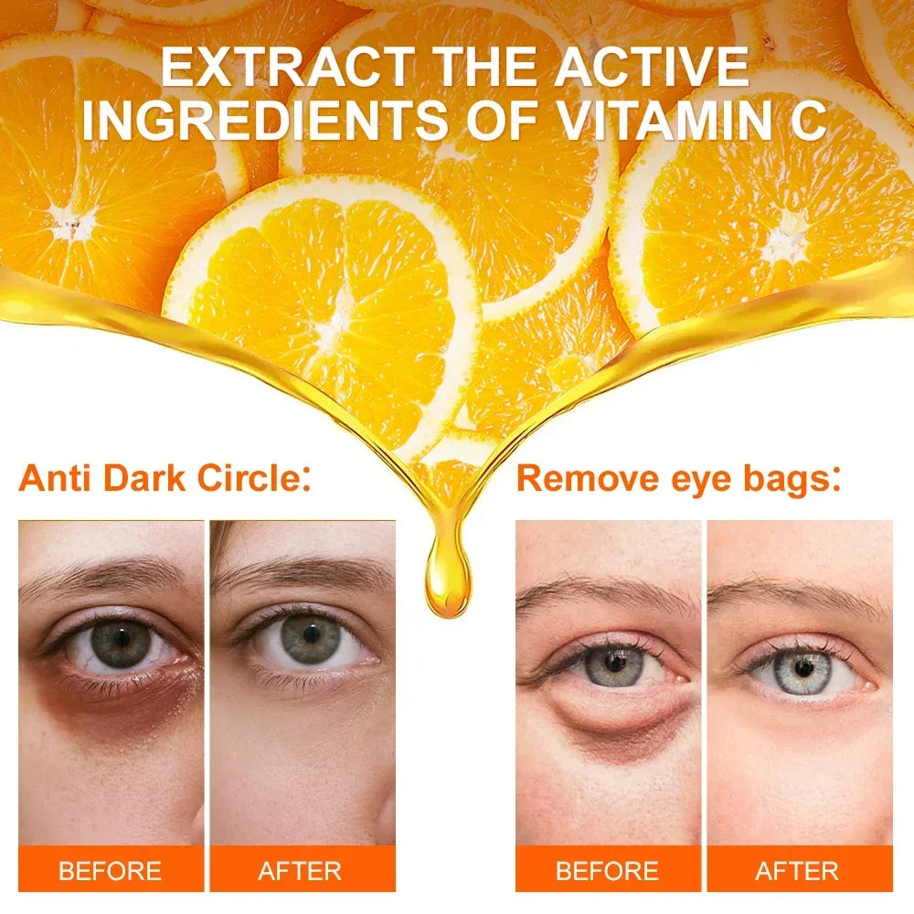 **Bright Eyes Ahead: VC Whitening Eye Cream to Banish Dark Circles & Puffiness – Experience Radiant Skin Today!**