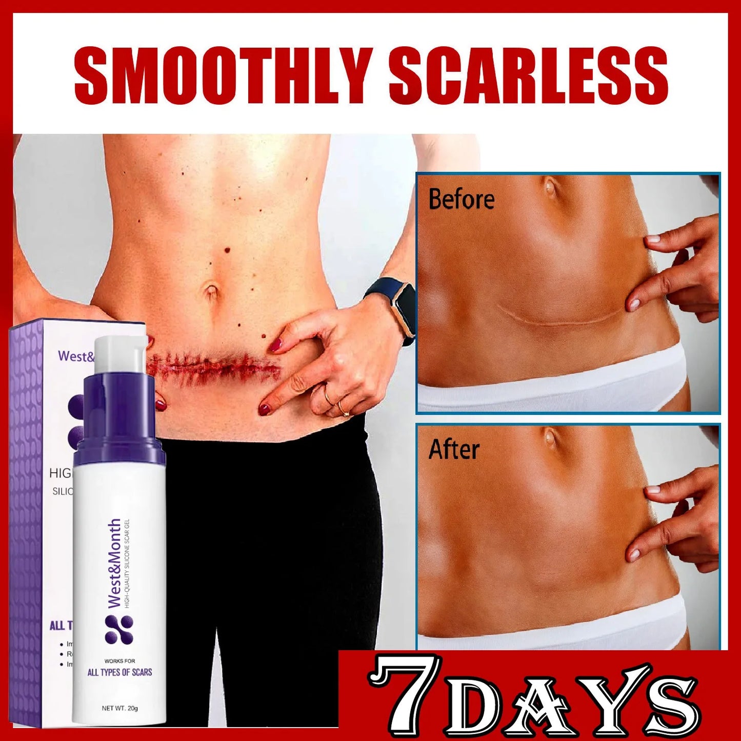 **Erase Scars Fast: Advanced Herbal Gel for Acne & Burn Recovery – Nourish and Brighten Your Skin with Every Application!**