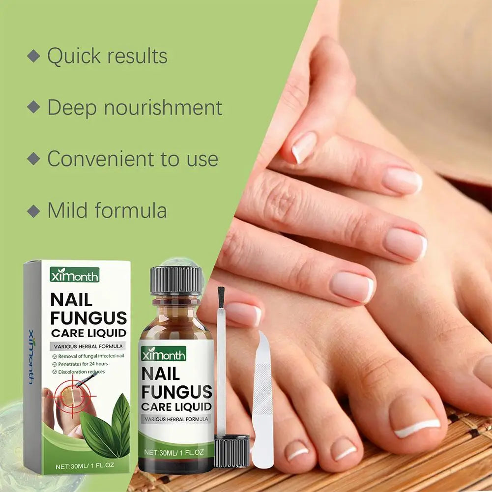 **Ultimate Nail Fungal Treatment - 50g Powerful Serum for Onychomycosis & Paronychia | Restore Healthy Nails & Banish Infections!**