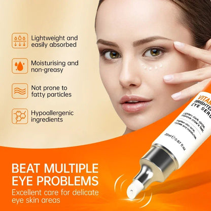 **Bright Eyes Ahead: VC Whitening Eye Cream to Banish Dark Circles & Puffiness – Experience Radiant Skin Today!**