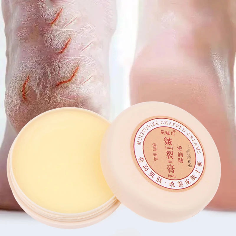 **Transform Your Feet with 20g Healing Foot Cream - Say Goodbye to Cracks and Hello to Silky Softness!**