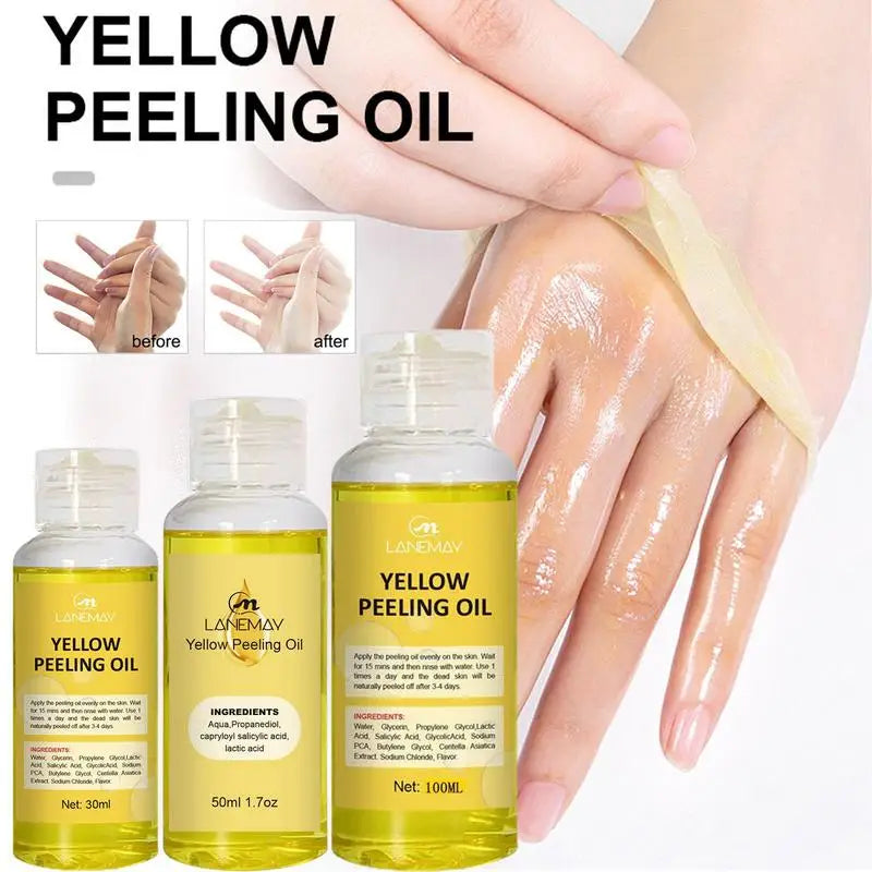 "Illuminate Your Beauty: Yellow Peeling Oil for Dark Skin - Exfoliating Treatment to Remove Dead Skin & Brighten Arms, Knees & Legs!"