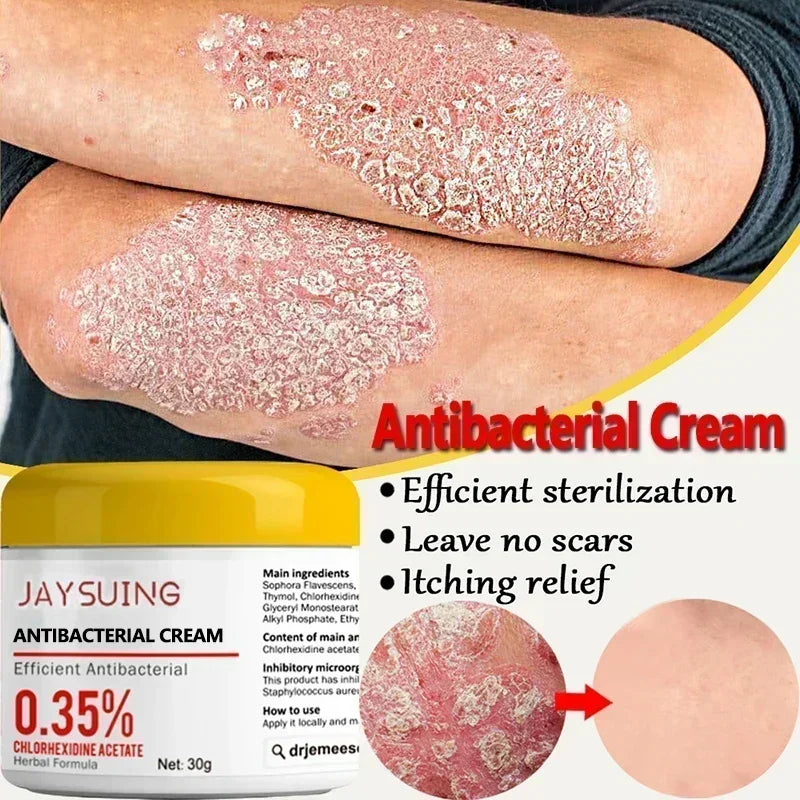 **Ultimate Psoriasis Relief Cream - 30g of Natural Moisturizer to Soothe Itchy, Rough Skin & Restore Hydration with Antibacterial Power!**