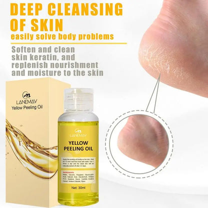 "Illuminate Your Beauty: Yellow Peeling Oil for Dark Skin - Exfoliating Treatment to Remove Dead Skin & Brighten Arms, Knees & Legs!"