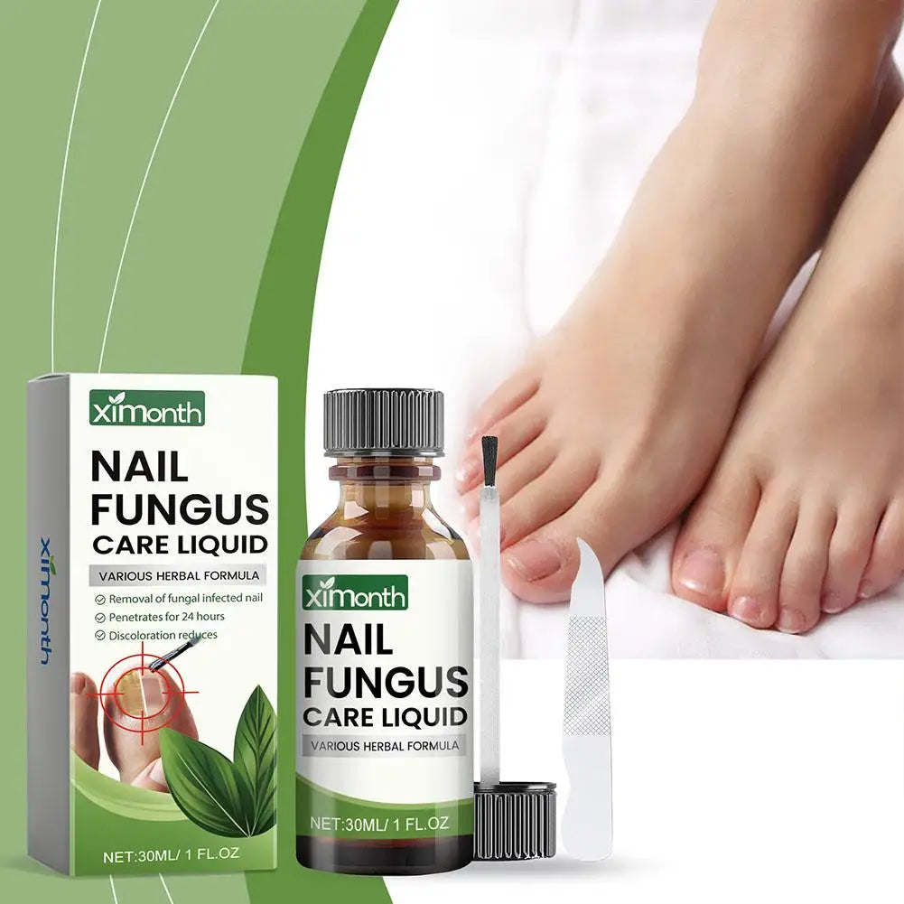 **Ultimate Nail Fungal Treatment - 50g Powerful Serum for Onychomycosis & Paronychia | Restore Healthy Nails & Banish Infections!**