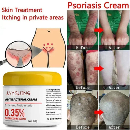 **Ultimate Psoriasis Relief Cream - 30g of Natural Moisturizer to Soothe Itchy, Rough Skin & Restore Hydration with Antibacterial Power!**