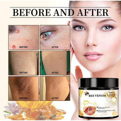 **Experience the Power of Nature: 60ml Bee Venom Skin Care Cream – Intensive Repair for Dry, Itchy Skin on Hands and Feet!**