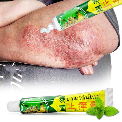 "Thailand’s Best-Kept Secret: 4-Pack Psoriasis & Eczema Cream - Refreshing Mint Ointment to Soothe Itchy Skin and Promote Healing Naturally!"