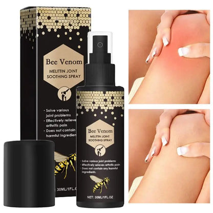 **Natural Bee Venom Joint Relief Cream & Massage Spray - Unlock Pain-Free Movement and Stronger Bones – Your Go-To Solution for Lasting Comfort and Care**