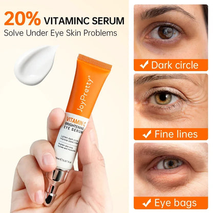 **Bright Eyes Ahead: VC Whitening Eye Cream to Banish Dark Circles & Puffiness – Experience Radiant Skin Today!**