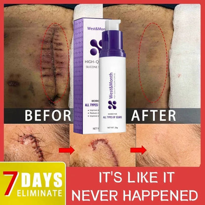 **Erase Scars Fast: Advanced Herbal Gel for Acne & Burn Recovery – Nourish and Brighten Your Skin with Every Application!**