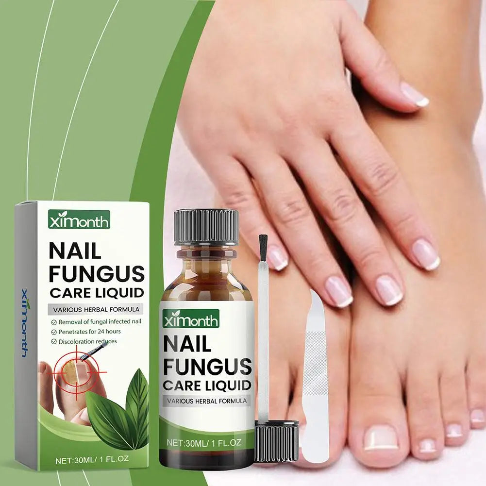 **Ultimate Nail Fungal Treatment - 50g Powerful Serum for Onychomycosis & Paronychia | Restore Healthy Nails & Banish Infections!**